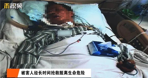 明知有毒，仍輕信自己手藝！上海一男子吃成植物人，廚師被判刑！