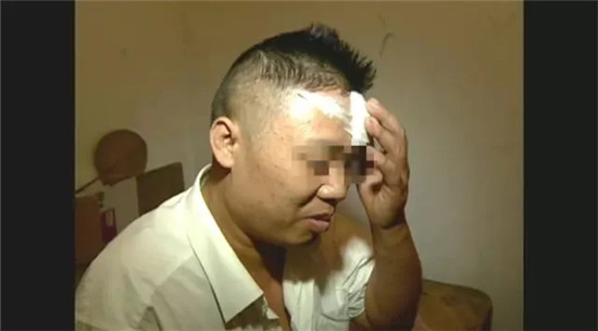 兩廚師因瑣事打架，其中一個被打破頭，然后，竟要求老板賠償10萬元……