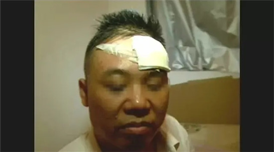 兩廚師因瑣事打架，其中一個被打破頭，然后，竟要求老板賠償10萬元……
