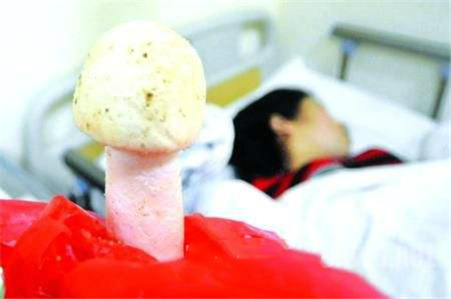 野生菌中毒高發期到了！這些野生蘑菇，千萬不要采、買，更不能吃！