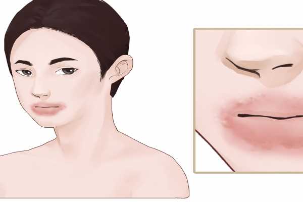 什么人應該少吃腰果？