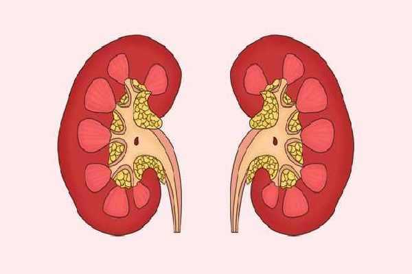 什么人應該少吃腰果？