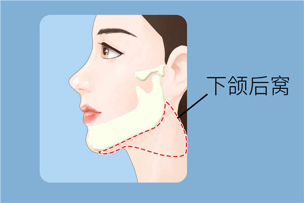 如何減掉雙下巴妙招
