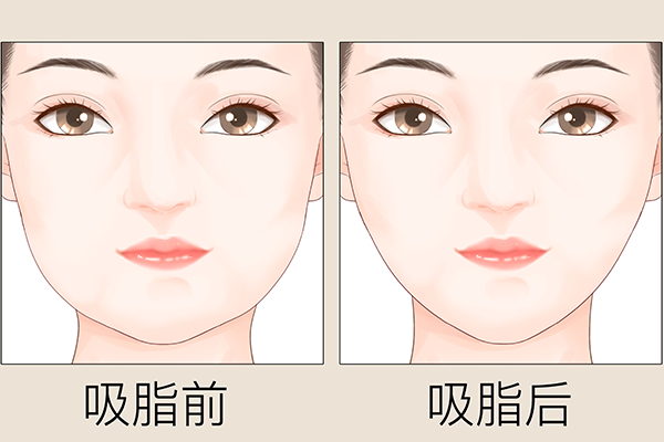 光纖溶脂的危害