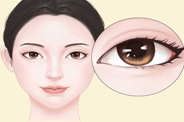 眼屈光手術(shù)是什么意思 什么是眼屈光手術(shù)