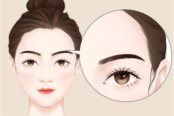 紋眉要注意什么