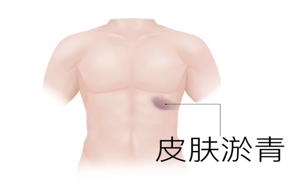 氬弧焊對身體有什么危害 氬弧焊對身體的潛在危害