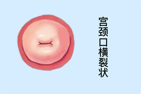 宮縮是什么感覺的 宮縮是什么樣的感覺