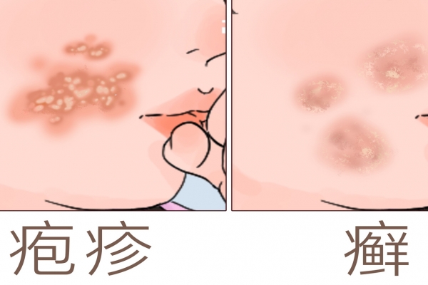 上海皮膚科醫院推薦