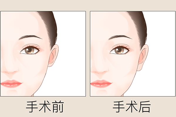 中國(guó)比較好的整形醫(yī)院排名第一